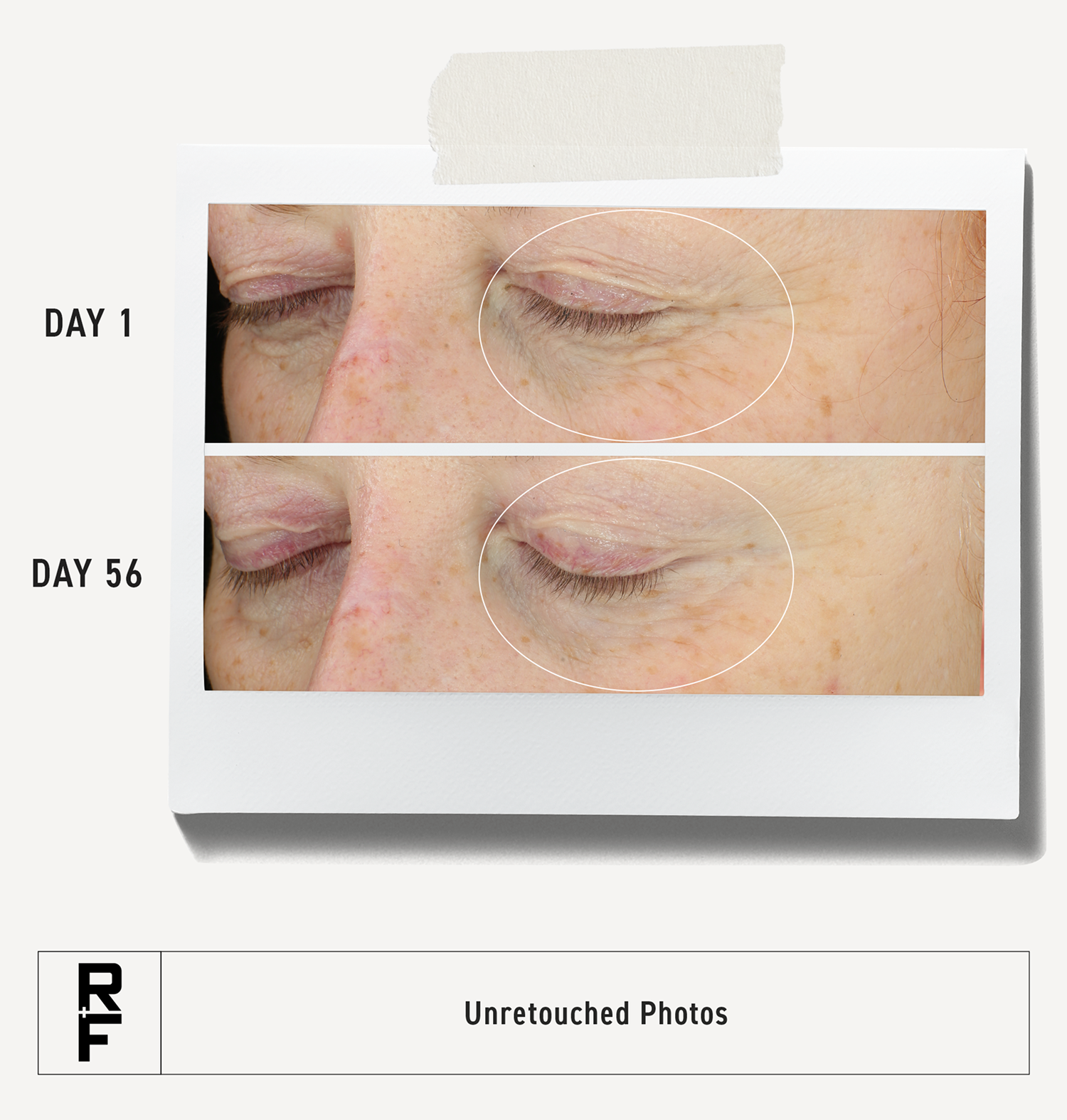 Younger Looking Eyes With Clinically Proven Results | Rodan + Fields®